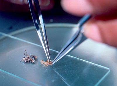 Dissection of a tsetse fly abdomen