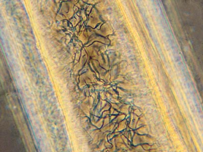 Trypanosoma congolense epimastigotes in tsetse proboscis